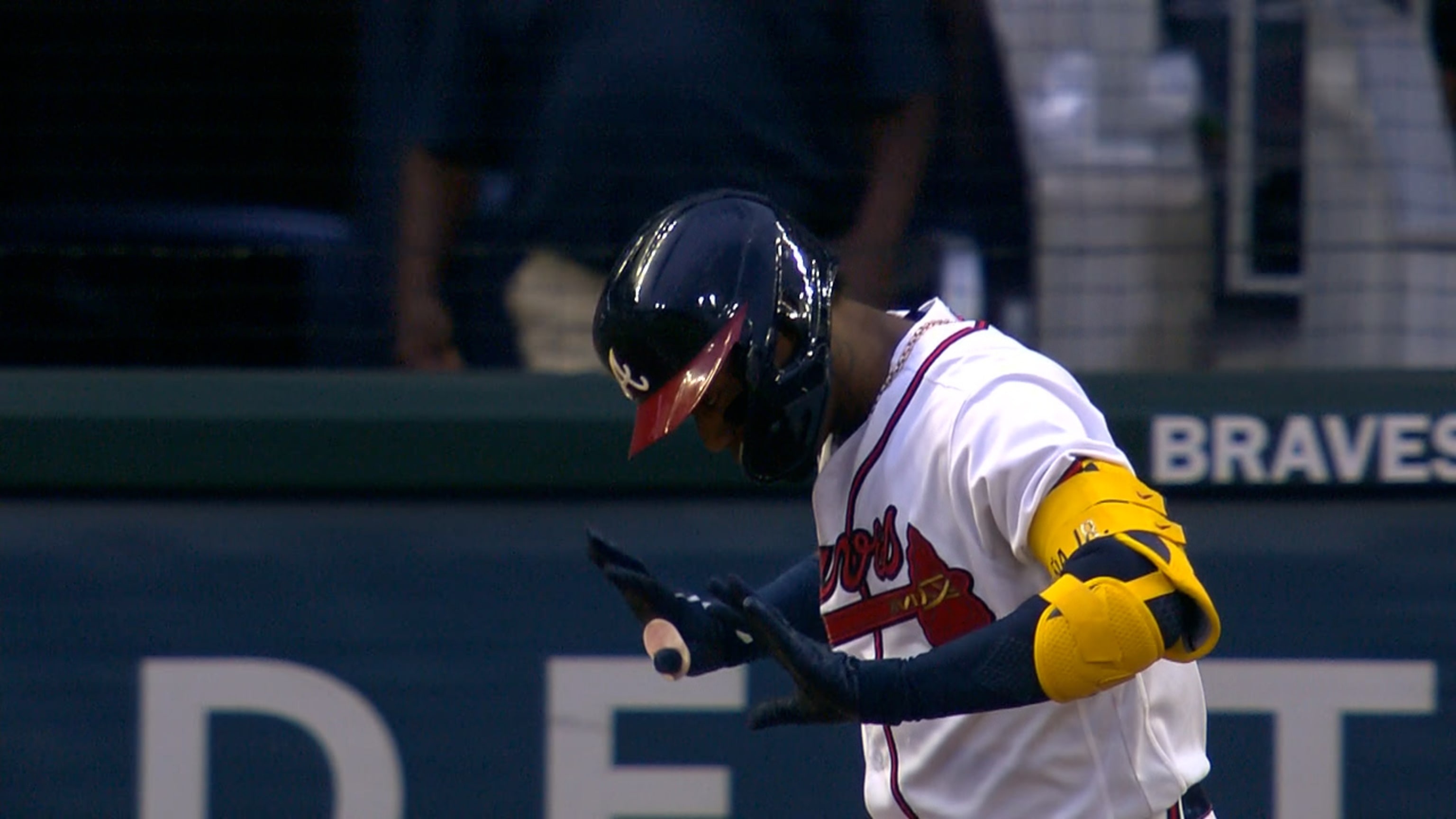 Braves' Ronald Acuña Jr. hit on the left elbow by a pitch, leaves game;  X-rays negative