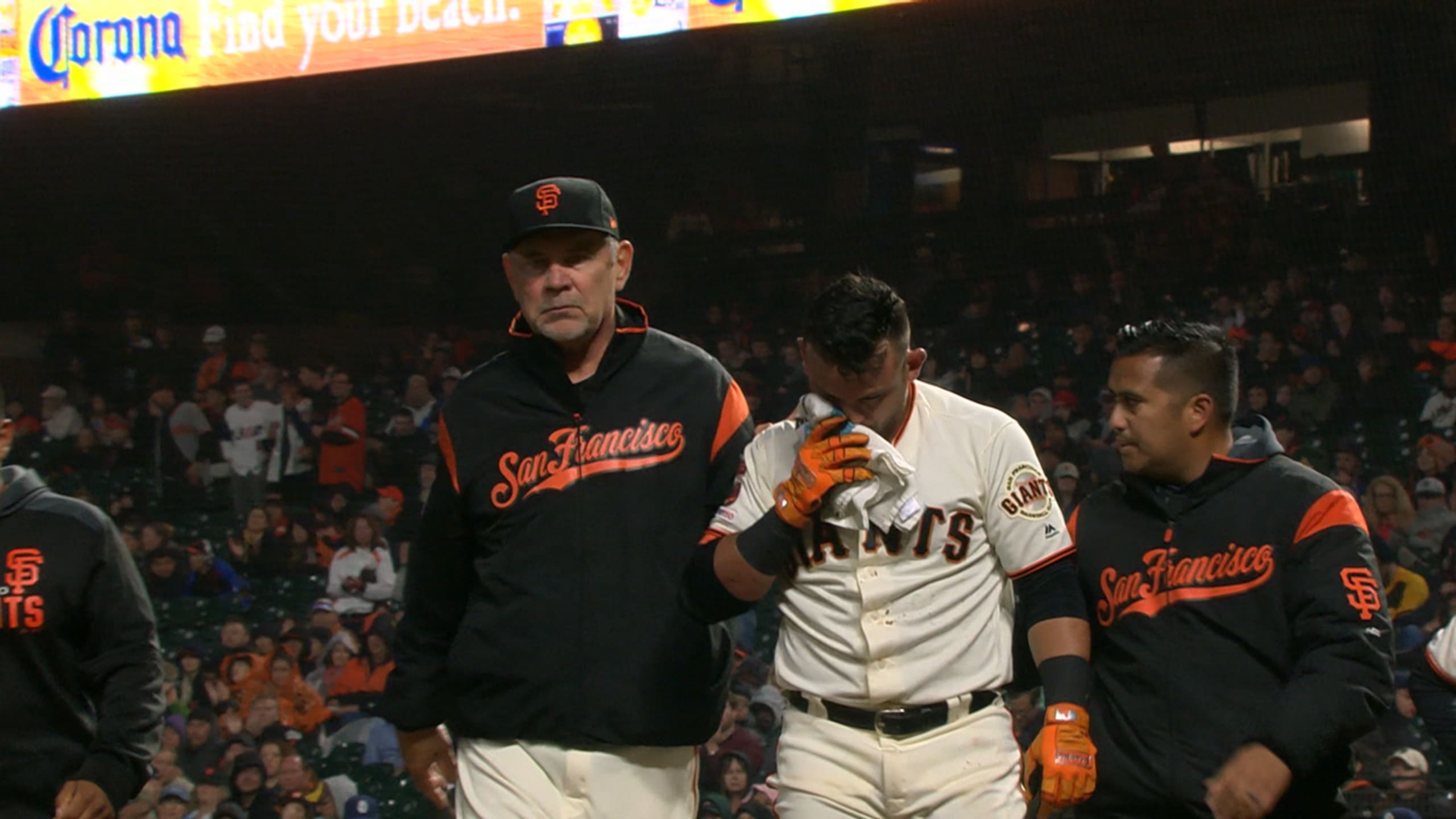 Parra hit in the face by pitch