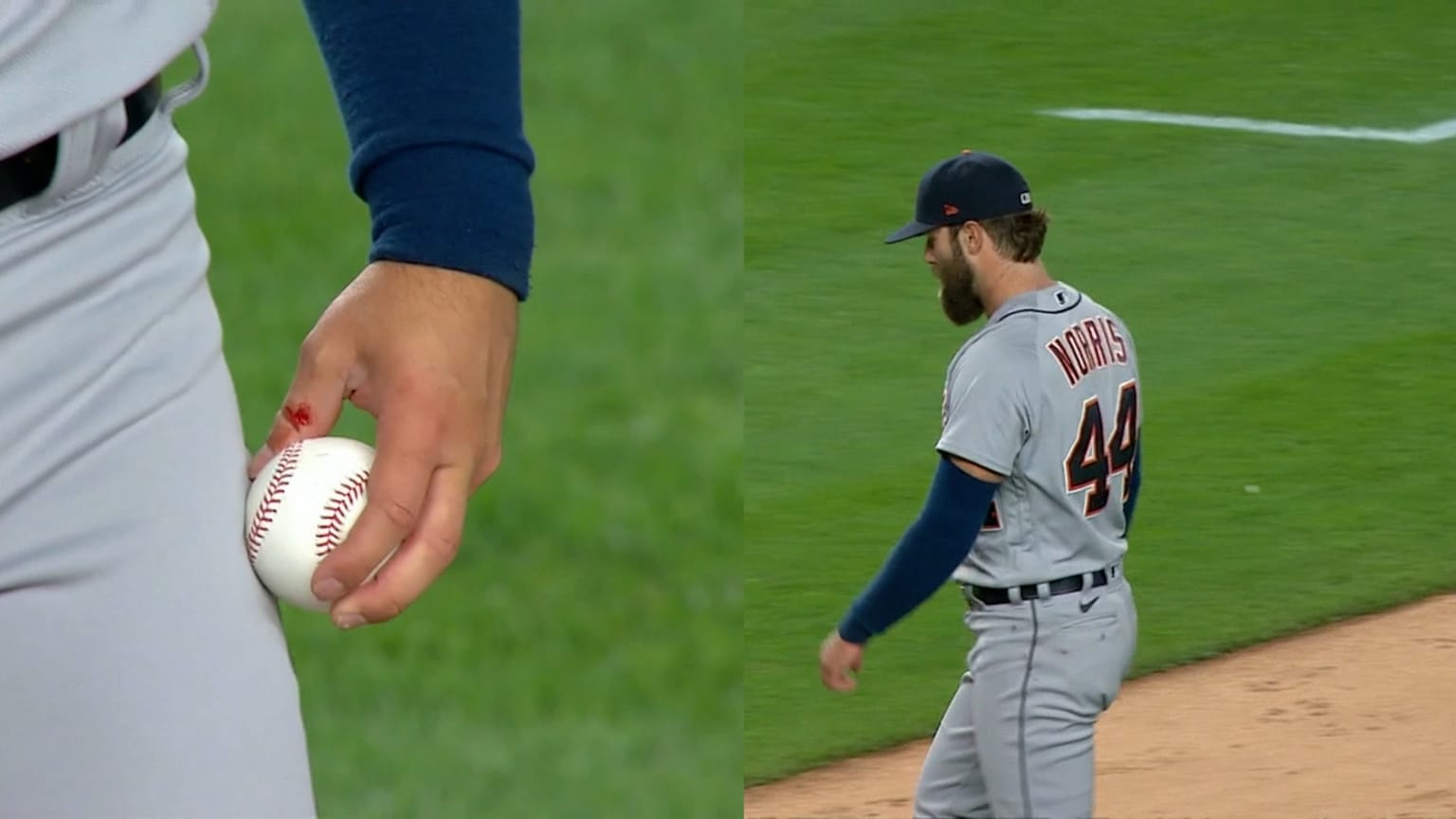 Batting blisters sales