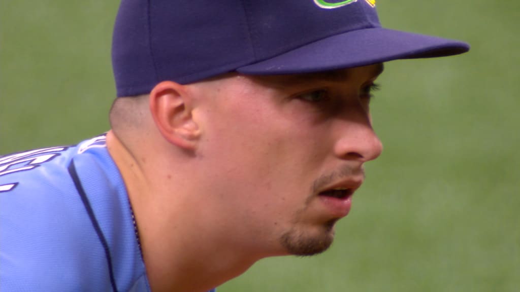 Snell on needing surgery