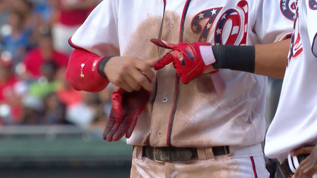 Turner breaks right wrist