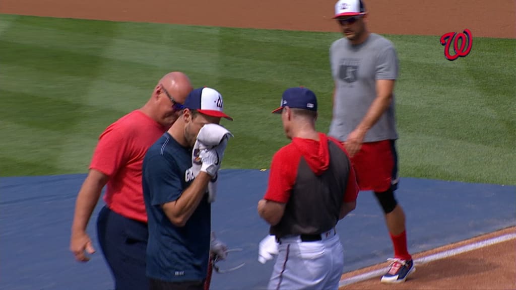 Behold: Max Scherzer's goggles - NBC Sports