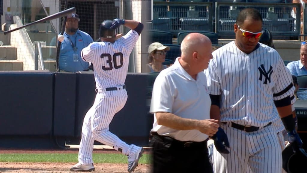 Edwin fractures wrist on HBP
