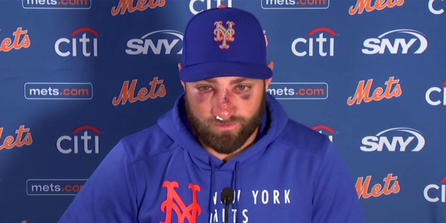 Kevin Pillar on injured list after HBP to face