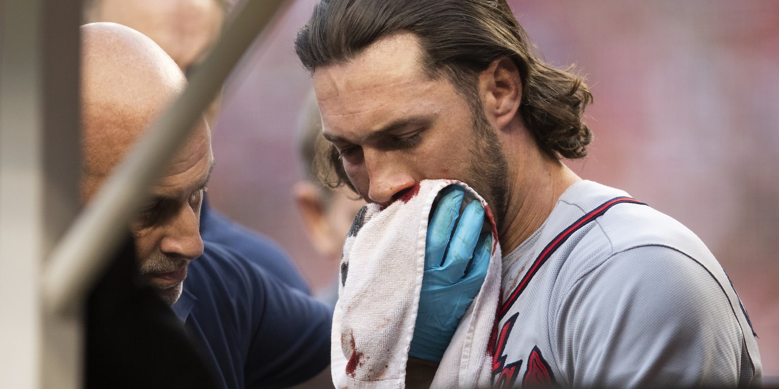 Charlie Culberson hit in face by pitch