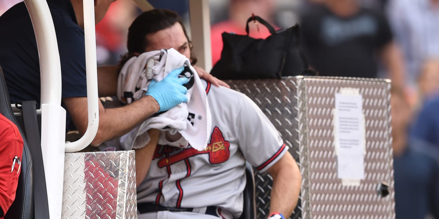 Braves Charlie Culberson face injury won't need surgery