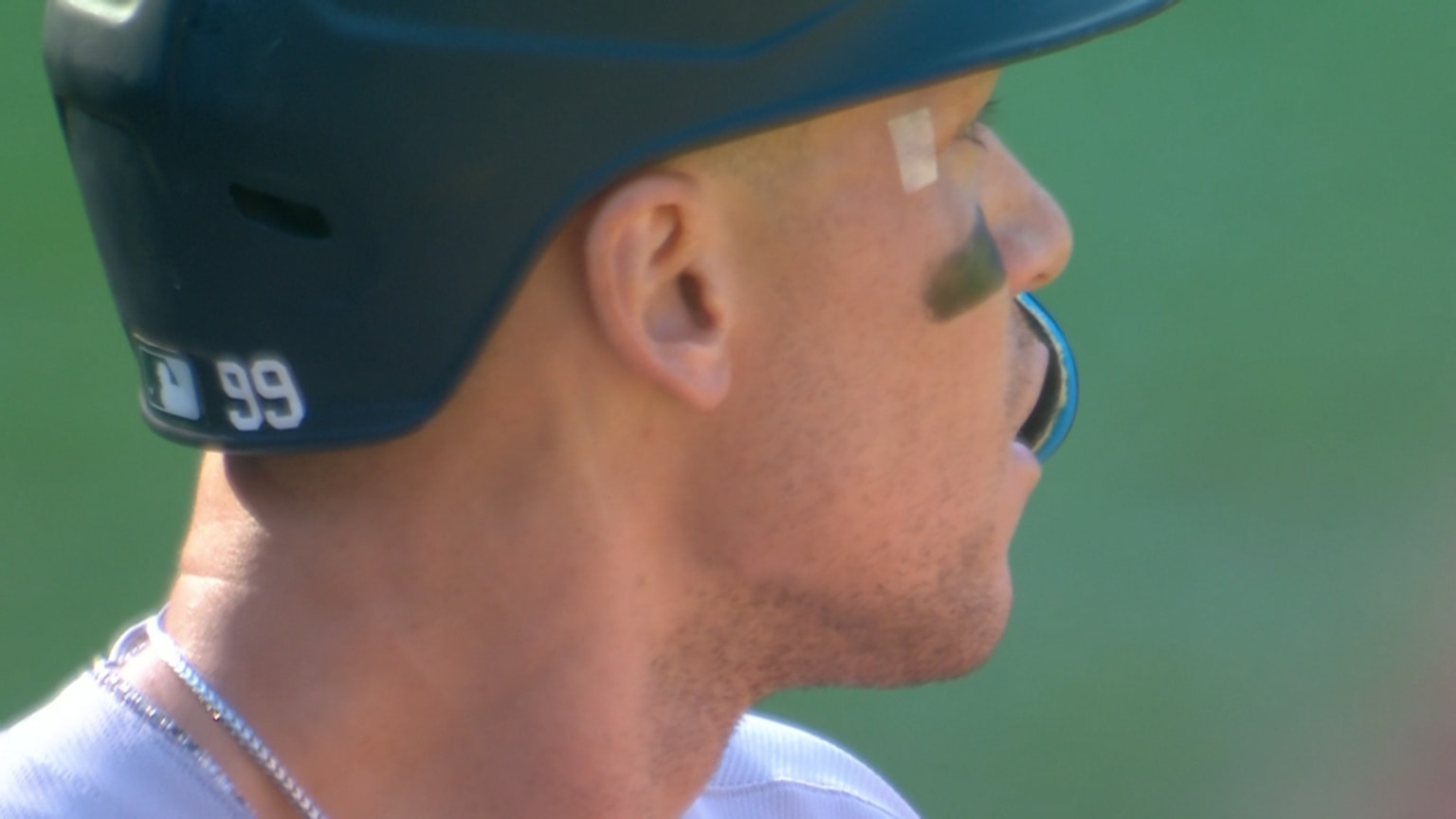 Aaron Judge gets hit in the face by a baseball | 07/05/2025 | MLB.com