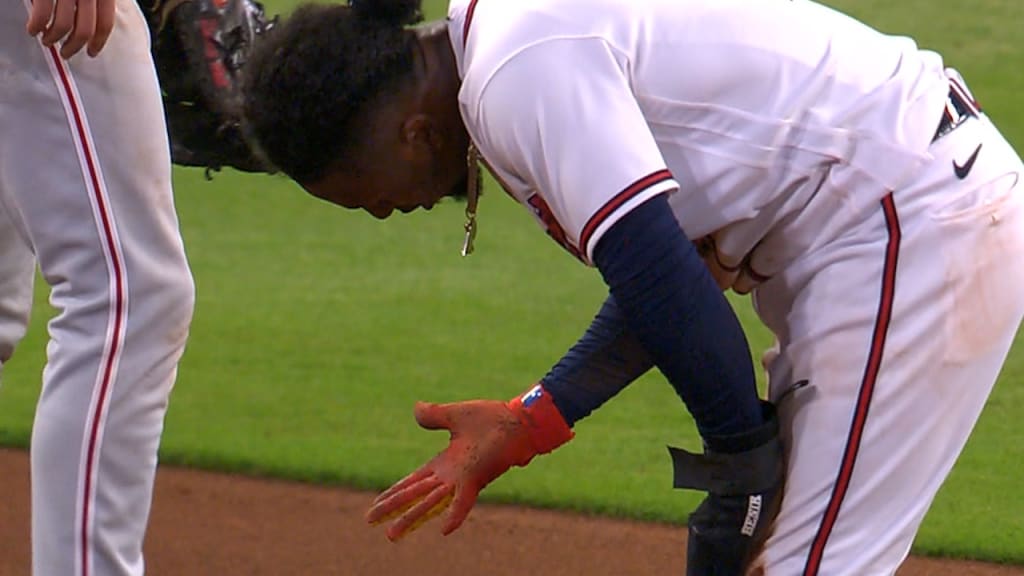 Ozzie Albies leaves game after hit by pitch - Battery Power