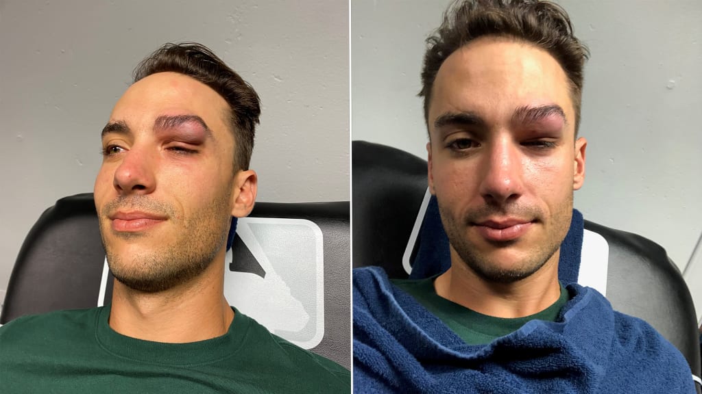 It took being struck in the face by a ball to make Matt Olson miss a game -- back in 2021.