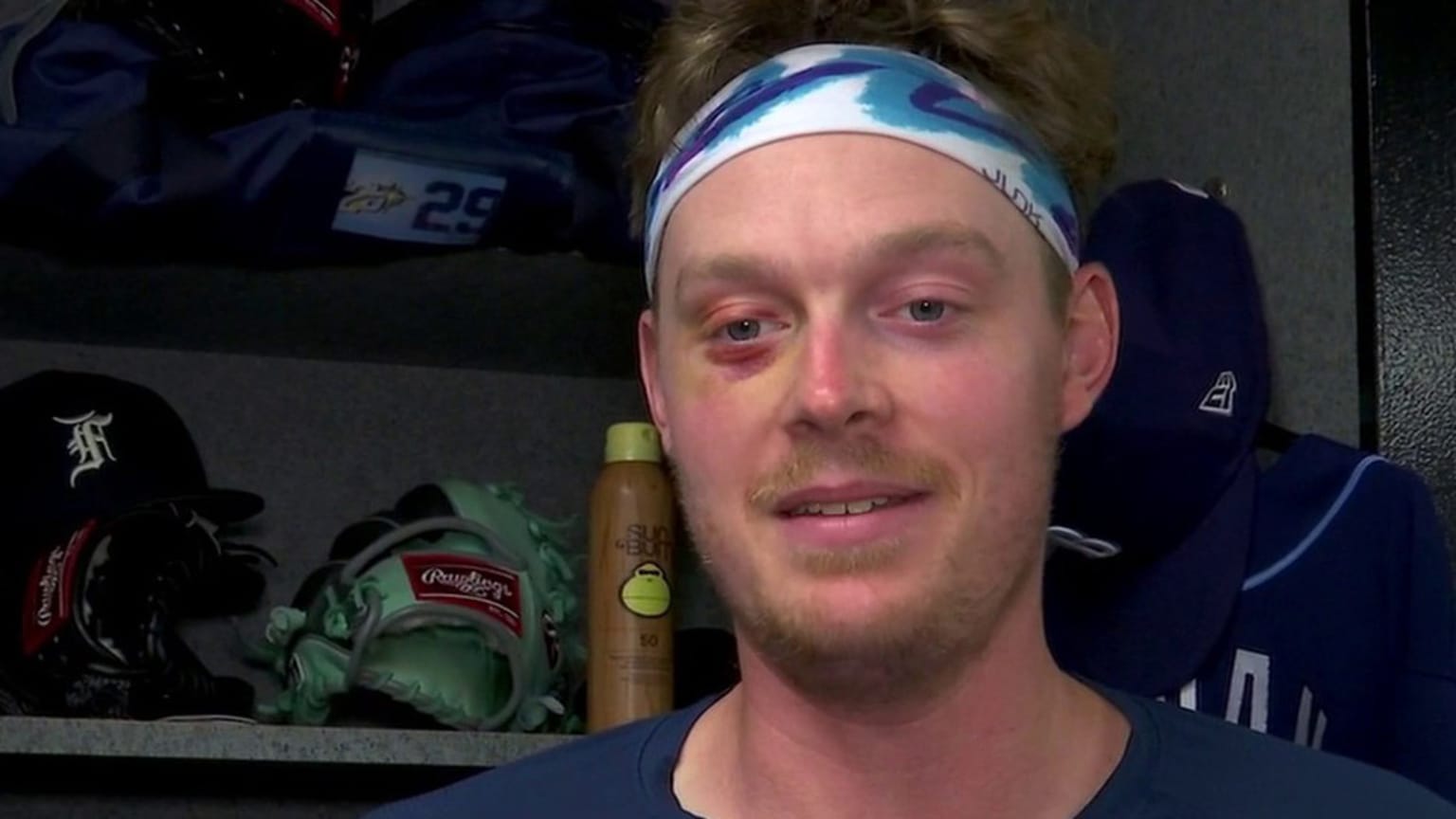 Pete Fairbanks stands in front of his locker with a black eye