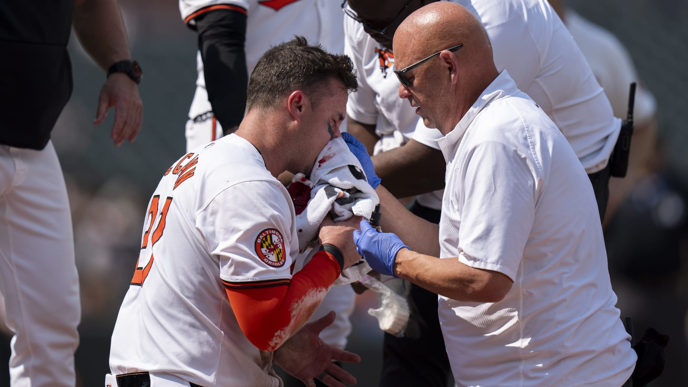 James McCann is treated after a fastball hit him in the face