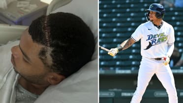 Rays prospect Isaac reveals 'life-saving' brain surgery