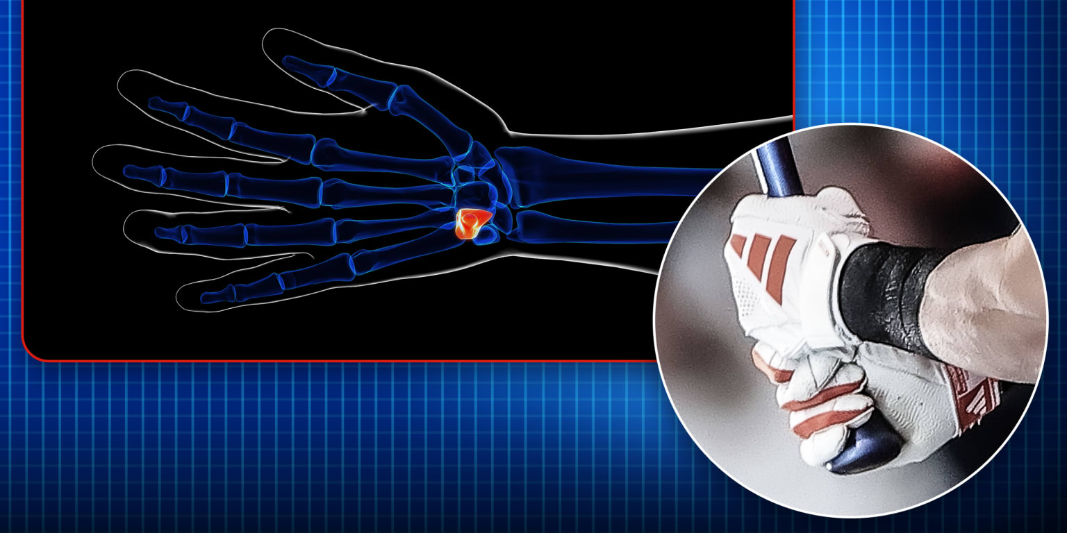 What is the hamate and why are so many players injuring theirs?