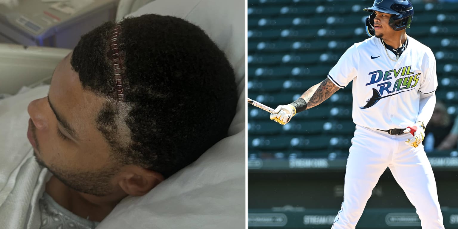 Rays prospect Isaac reveals 'life-saving' brain surgery 